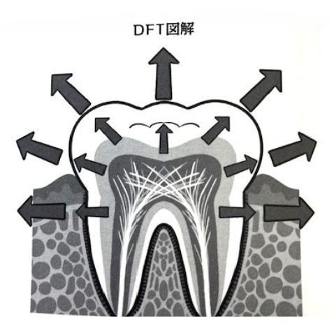 DFT図解