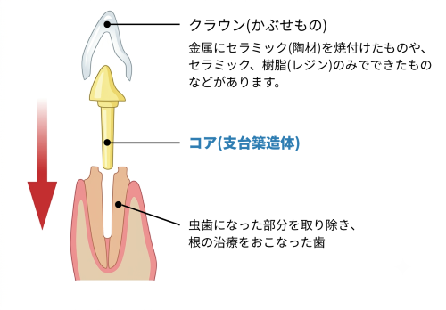 歯科 治療